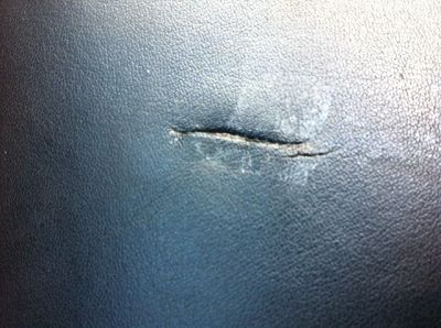 leather scar
