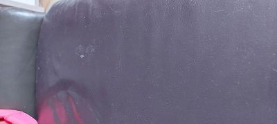 Problème pigmentation